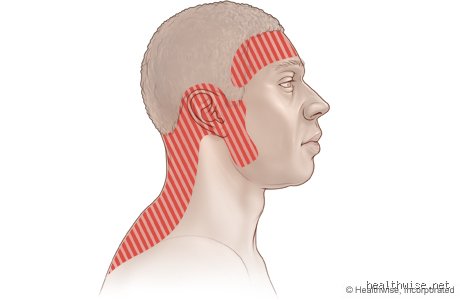 ¿Dónde duele cuando se sube la presión arterial y qué significa para tu cuerpo realmente?