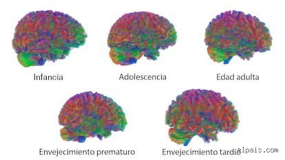¿Cuáles son las cuatro edades del cerebro y cómo dictan nuestra forma de percibir el mundo?
