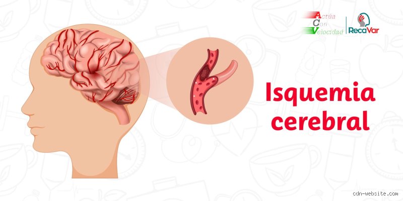 ¿Cuáles son los síntomas de la falta de sangre en el cerebro?