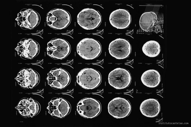¿Cuánto tarda el cerebro en recuperarse de una adicción? Un viaje por la neurobiología de la resiliencia humana