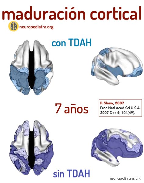 ¿Las personas con TDAH maduran? Entendiendo el desarrollo neurológico y emocional