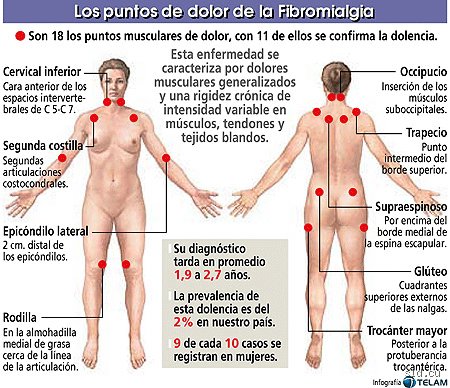 ¿Cómo anda una persona con fibromialgia?