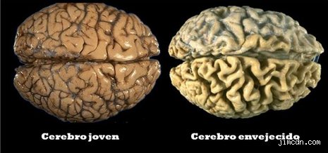 ¿Cómo es el cerebro de una persona de 80 años realmente por dentro y qué ocurre en su estructura?