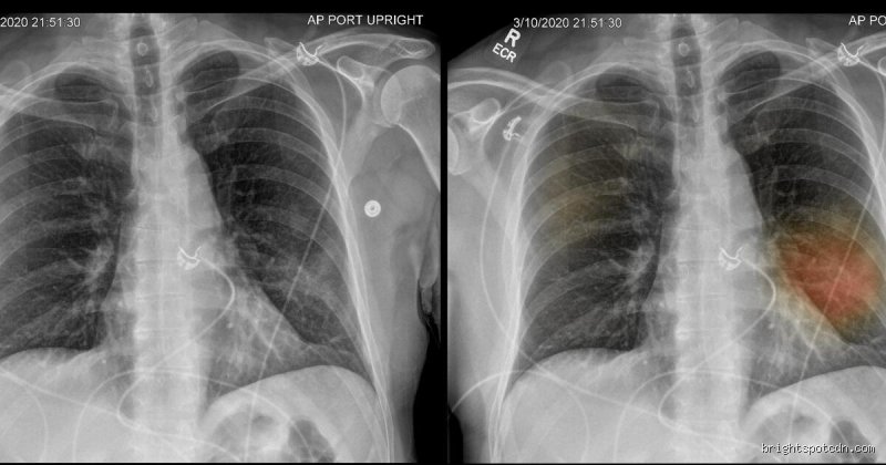 ¿Cómo saber si mi pulmón está enfermo? Señales de alerta, ciencia respiratoria y lo que tu cuerpo intenta gritarte