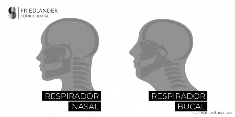¿Consecuencias de respirar por la boca en adultos? Todo lo que tu cuerpo sufre mientras mantienes las mandíbulas abiertas