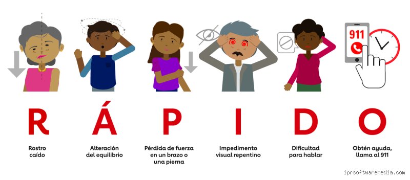 ¿Cuáles son las 5 señales de advertencia de un derrame cerebral?