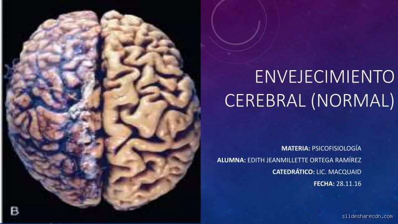 ¿Cuáles son los signos normales del envejecimiento cerebral y cómo distinguirlos de una demencia?