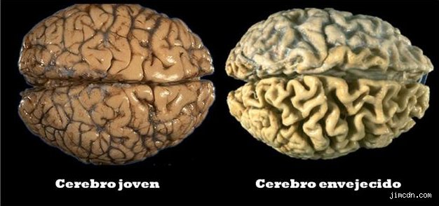 ¿Cuáles son los síntomas de un cerebro envejecido? Guía completa para identificar el desgaste cognitivo real