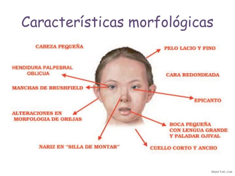 ¿Cuáles son las verdaderas cualidades de personas con síndrome de Down más allá de los estereotipos de siempre?
