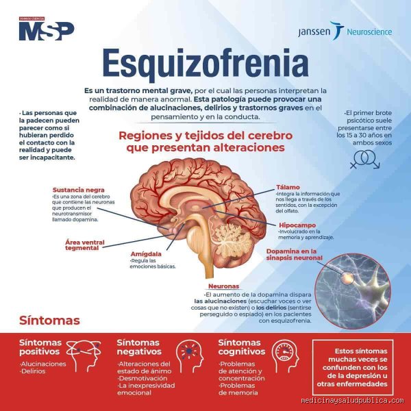 ¿Cuándo la esquizofrenia es peligrosa? Desmontando el estigma mediante la realidad clínica y el análisis de riesgos reales