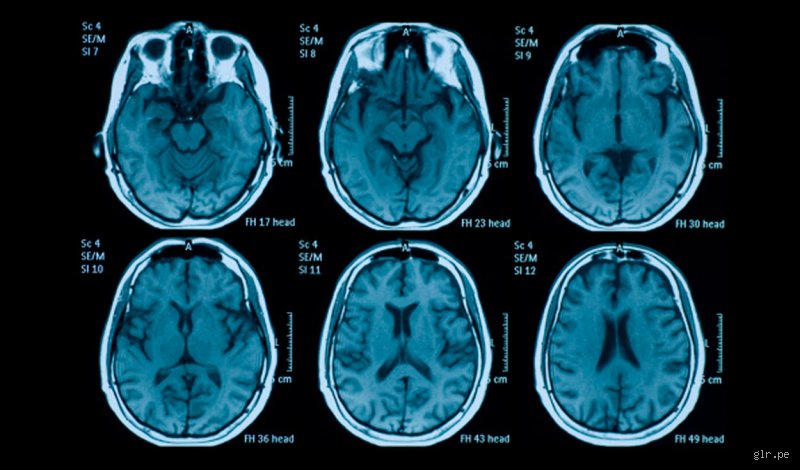 ¿Cuánto puede aguantar el cerebro sin dormir?