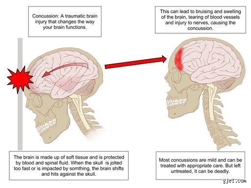 ¿Cuánto tiempo tarda en recuperarse el cerebro? La ciencia real detrás de la reparación neuronal tras un trauma