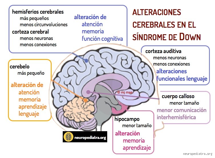 ¿Las personas con síndrome de Down tienen capacidad mental? Desmontando mitos sobre el potencial cognitivo y la neurodiversidad real