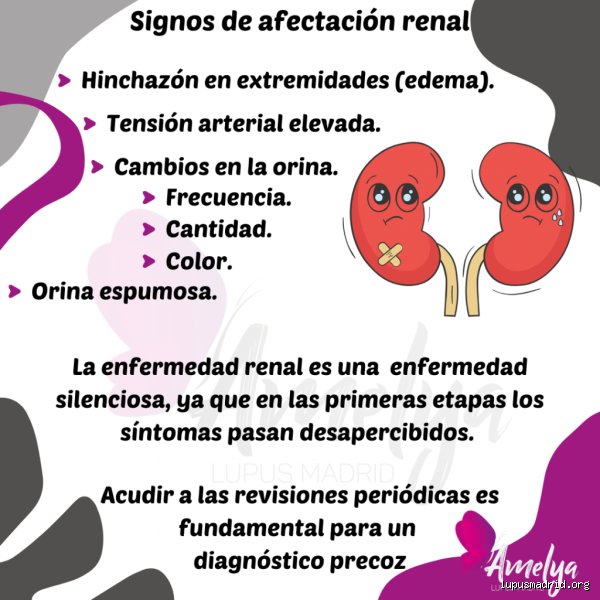 ¿Qué pasa cuando el lupus ataca los riñones? (Primera Parte: Anatomía de una tormenta inmunológica)