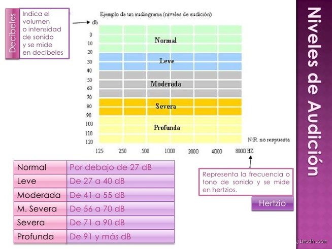 ¿Una audición de 0 dB es buena? Entendiendo el umbral del silencio absoluto en un mundo lleno de ruido