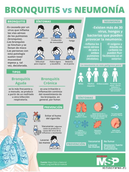 ¿Una tos con flema significa neumonía? Desmontando mitos sobre la mucosidad y la salud pulmonar