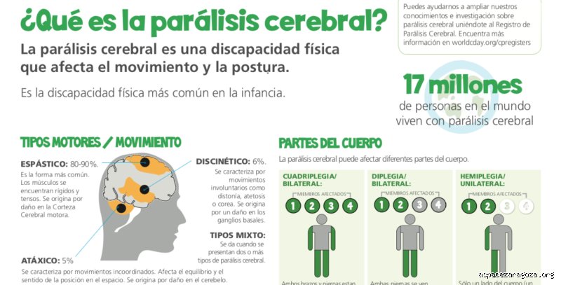 ¿Qué es la parálisis cerebral severa? Una mirada profunda a su naturaleza, impacto clínico y desafíos (Primera Parte)