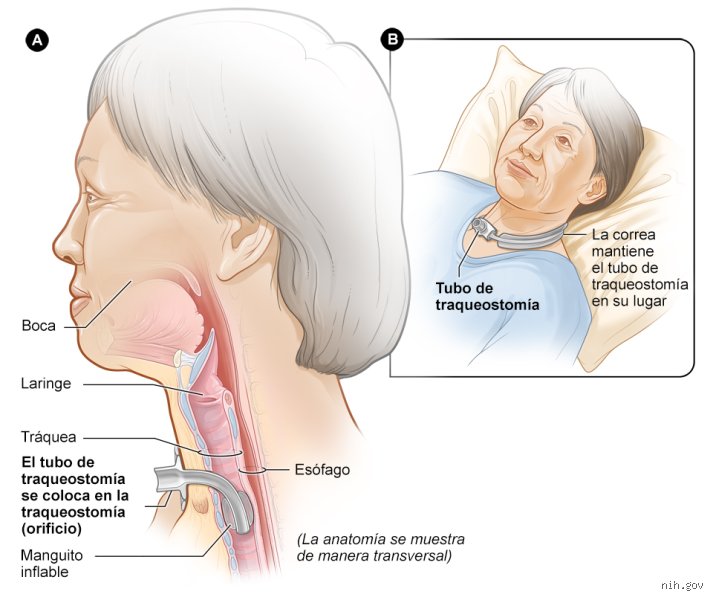 ¿Es posible que los pulmones se recuperen tras una insuficiencia respiratoria o estamos ante un daño irreversible para el organismo?