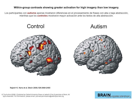 ¿Cómo aprende el cerebro autista?