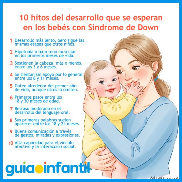 ¿Cómo es el carácter de un niño con síndrome de Down?