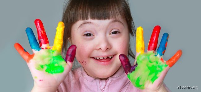 ¿Cómo es la mentalidad de un niño con síndrome de Down?