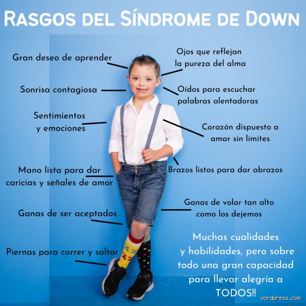 ¿Virtudes de los niños con síndrome de Down?