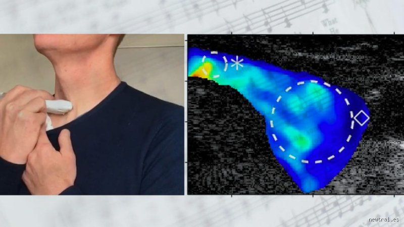 ¿Cantar ayuda a la tiroides?