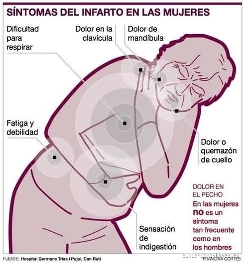 ¿Cómo empieza un infarto en una mujer?