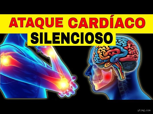 ¿Cómo es un paro cardíaco silencioso?