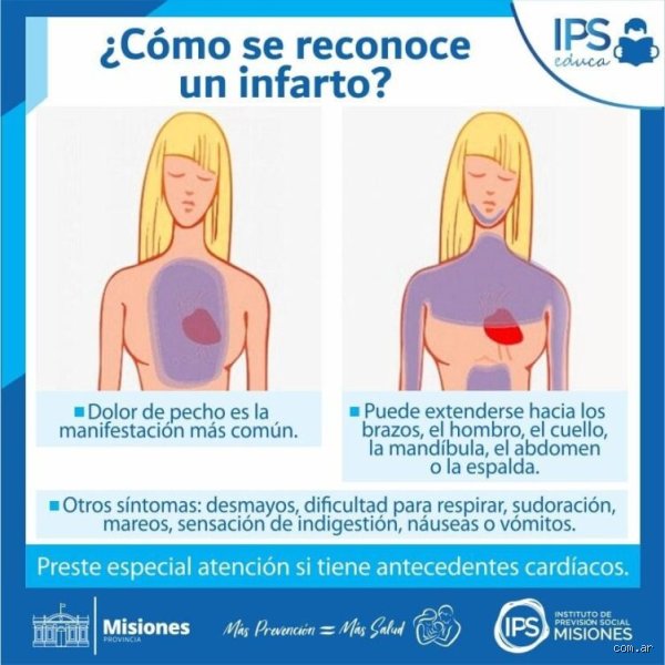 ¿Cómo se reconoce un preinfarto?