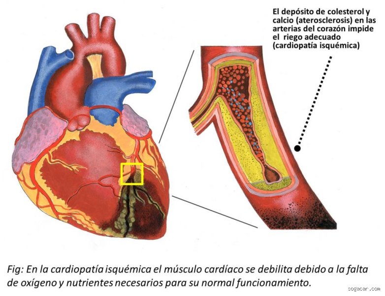 ¿Cuál es el primer indicio de que el corazón está empezando a fallar?