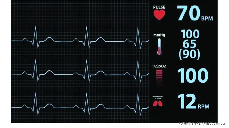¿Cuál es el ritmo cardíaco mínimo al que puede llegar su cuerpo de forma segura?