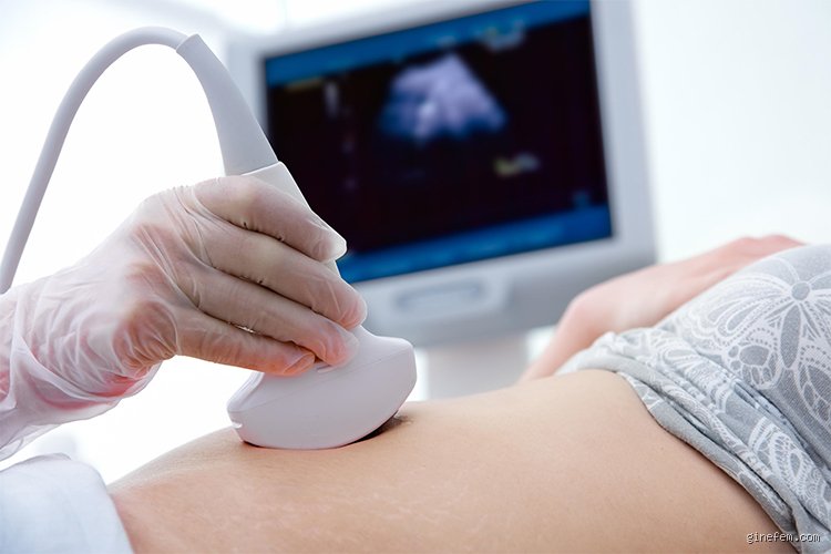 ¿Cuándo es necesario hacer un doppler?