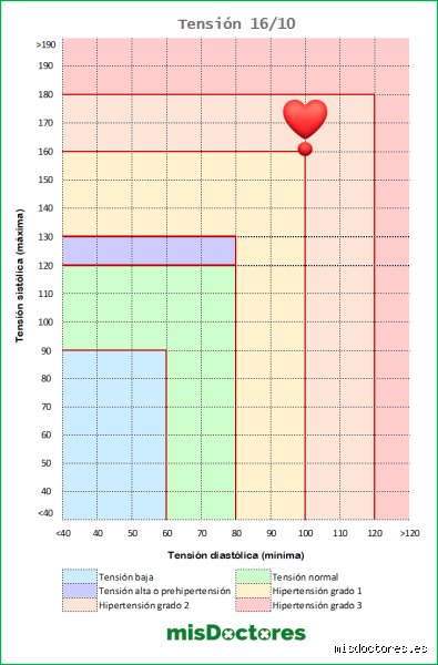 ¿Debo ir al hospital si mi presión arterial es de 160/100?