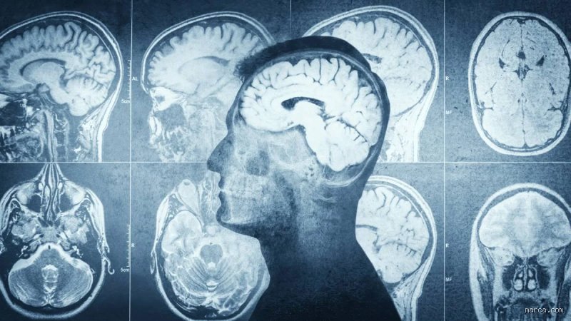 ¿Desaparecen los mini infartos?