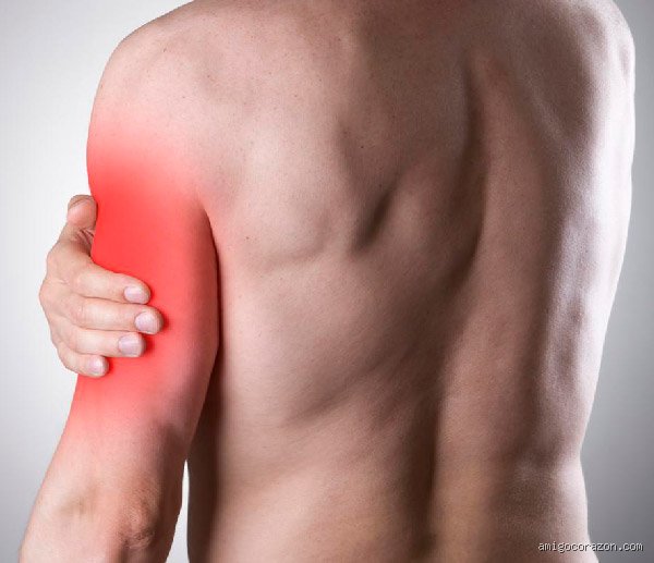 ¿Dónde duele el brazo en un infarto?