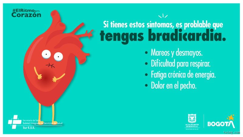 ¿Dónde duele la bradicardia?