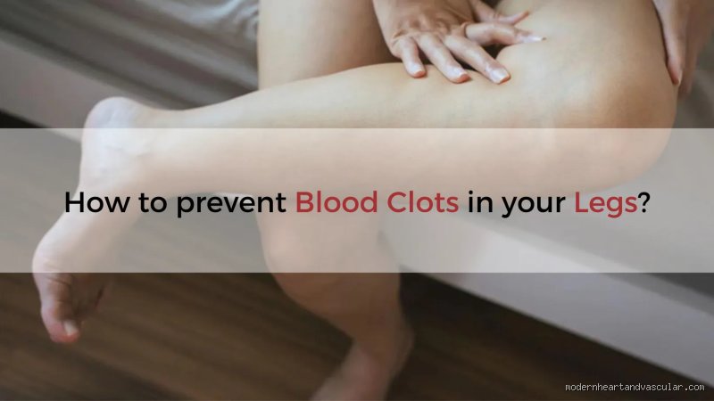 ¿Elevar las piernas puede provocar coágulos de sangre?