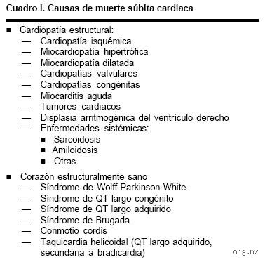 ¿La bradicardia causa muerte súbita?
