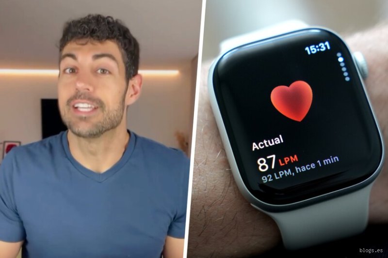 ¿Recomiendan los cardiólogos el Apple Watch?