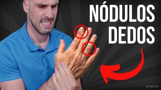 ¿De verdad funcionan los ejercicios para los dedos?