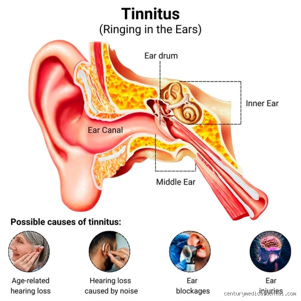 ¿Cómo es el ruido del tinnitus?