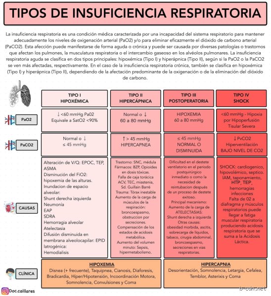 ¿Cómo identificar la insuficiencia respiratoria tipo 1 y tipo 2?