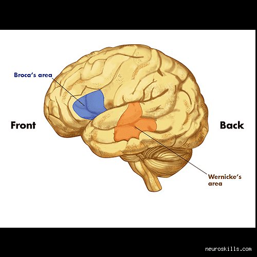 ¿Cómo perciben el lenguaje las personas con daño cerebral?