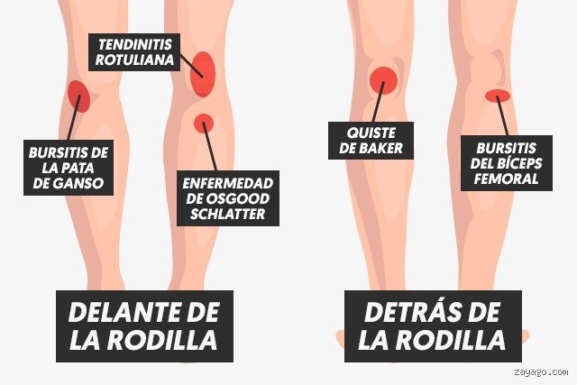 ¿Cómo quitar el dolor de rodilla rápido y efectivo?