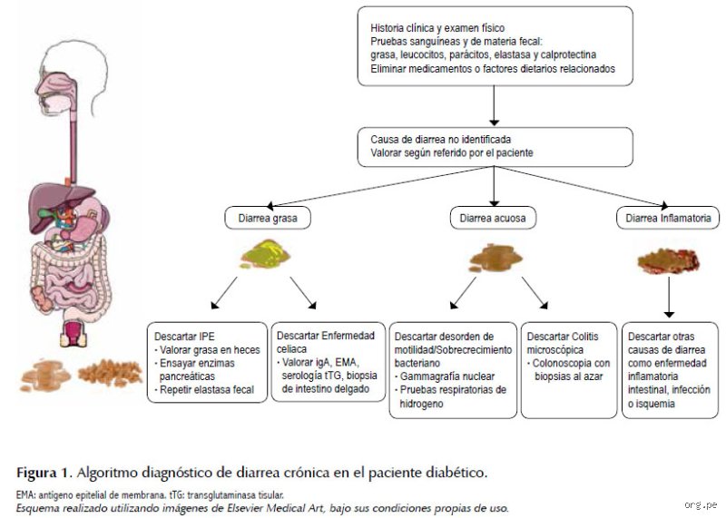 ¿Cómo quitar la diarrea rápido en adultos con diabetes?