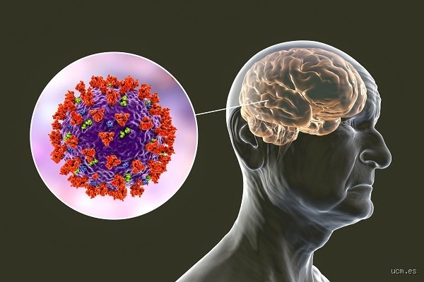 ¿Cómo se llama el virus que ataca al cerebro?