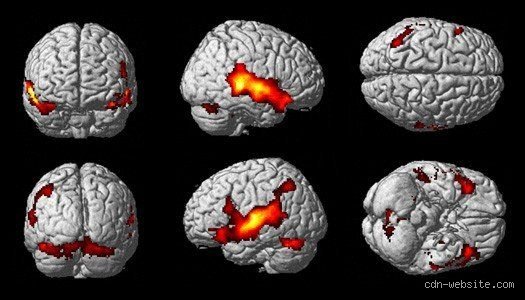 ¿Cómo se llama la enfermedad que daña el cerebro?