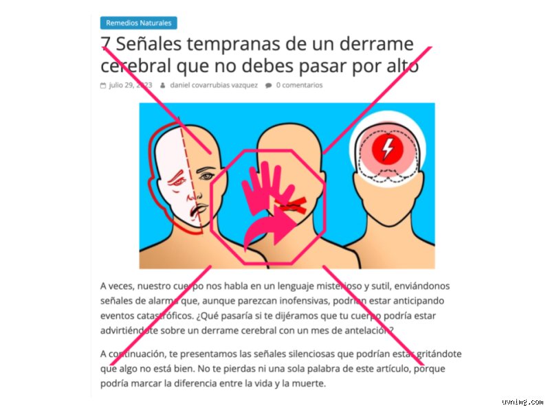 ¿Cómo te avisa el cuerpo antes de un derrame cerebral?
