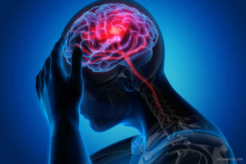 ¿Cuál es el daño cerebral más grave?